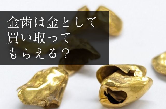 金歯は金として買い取ってもらえる？歯が付いていてもいいの？ | 金プラチナの高額買取なら実績No.1のリファスタ